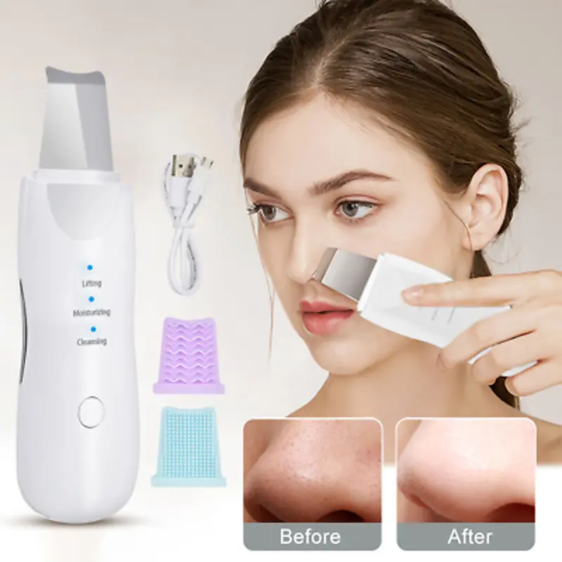 (Net) Shovel Skin Machine Skin Scrubber Facial Skin Scrubber Ultrasonic Skin Scrubber Spatula, Electric Blackhead Remover KN-276